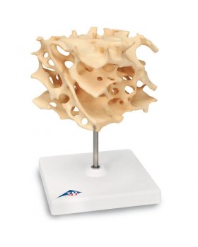 Kansellöz Kemik (süngerimsi kemik) Modeli, 100 Kat Büyütülmüş İmitasyon