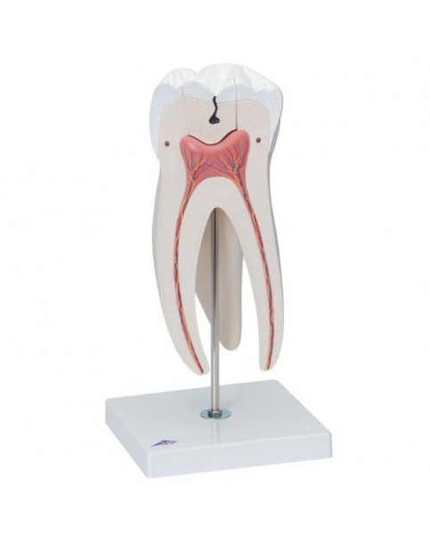 Diş Modeli, 6 Parçalı