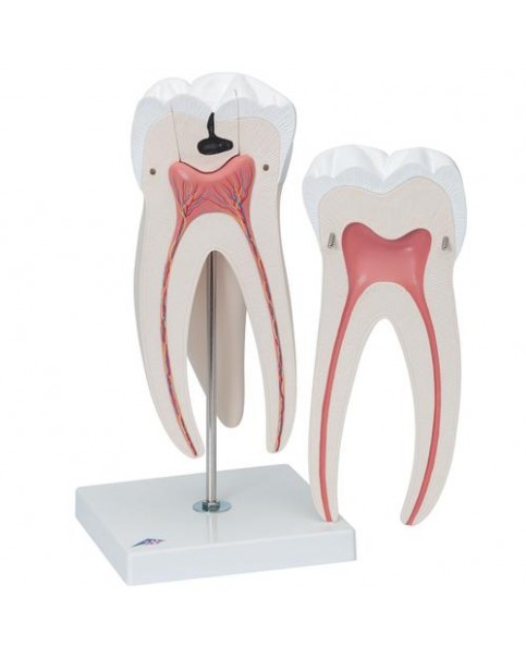 Diş Modeli, 6 Parçalı