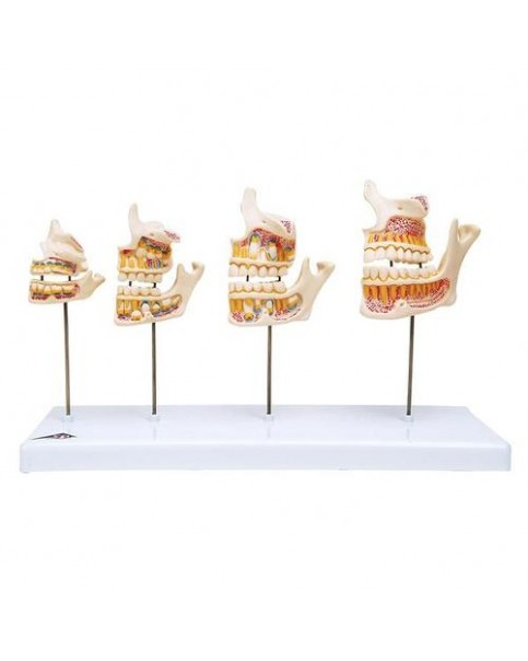 Diş Gelişim Modeli