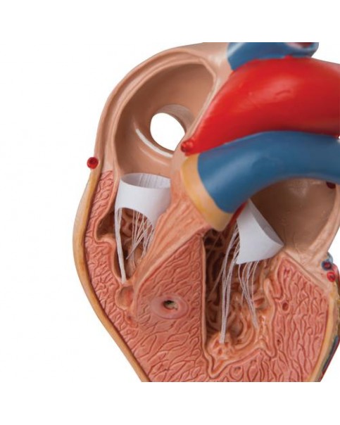 Sol Ventriküler Hipertrofi İle Klasik Kalp Modeli (LVH), 2 Parçalı