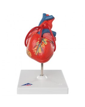 Baypaslı Kalp Modeli, 2 Parçalı