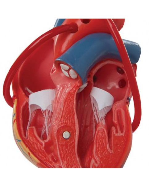 Baypaslı Kalp Modeli, 2 Parçalı
