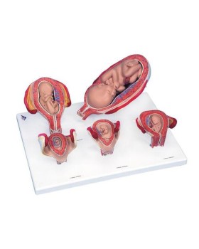Hamilelik Serisi, 5 Model