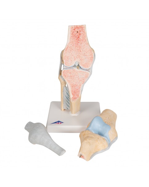 Diz Eklemi Kesit Modeli, 3 Parçalı