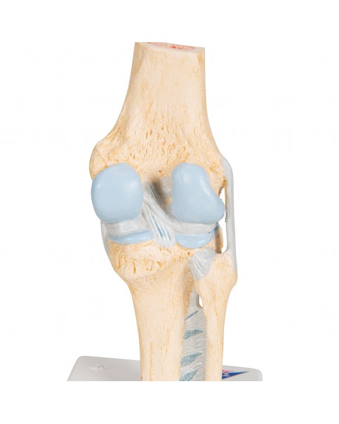 Diz Eklemi Kesit Modeli, 3 Parçalı