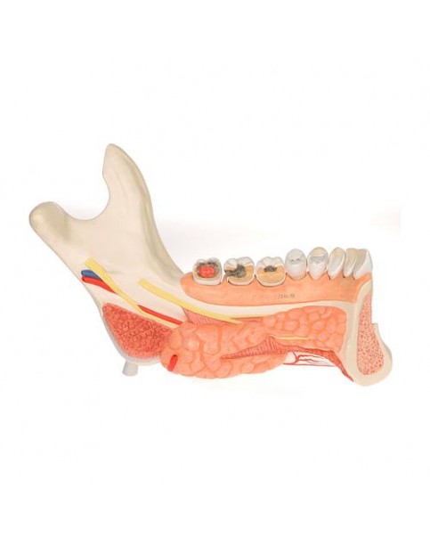 Alt Çene Modeli, 19 Parçalı, 8 Çürük Dişli