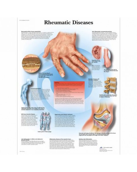 El ve El Bileği Anatomisi Posteri