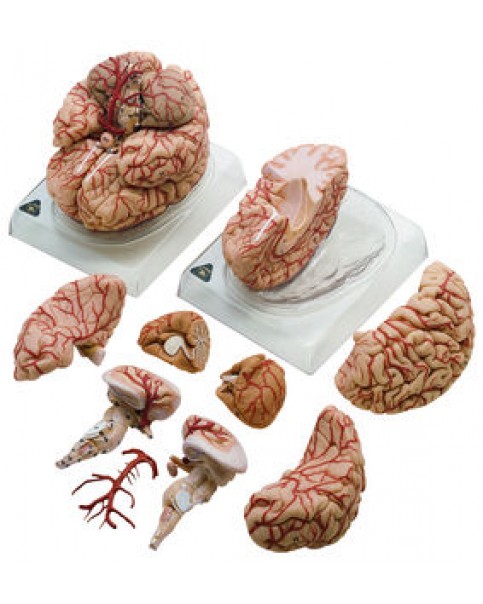Arterli Beyin Modeli