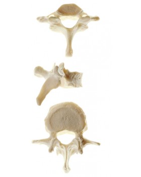 Vertebra