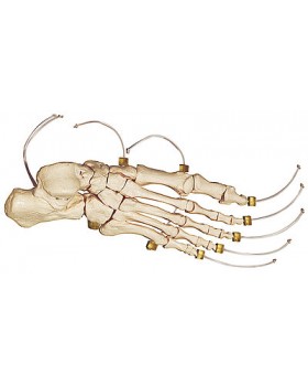 Naylon Ayak İskeleti